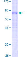 12.5% SDS-PAGE Stained with Coomassie Blue